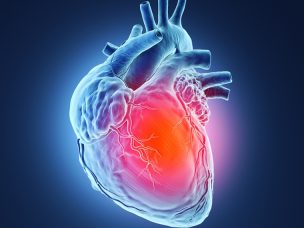 U.S. Patterns for Recurrent Coronary Heart Disease Examined