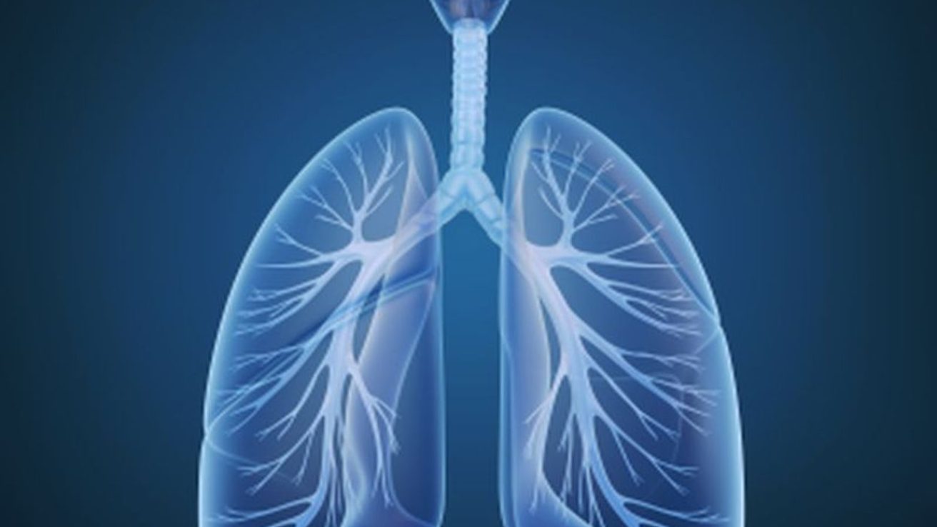 AI Model Using Chest X-Ray May Predict 12-Year Lung Cancer Risk