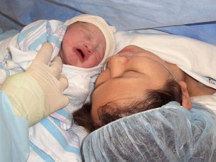 Elective C-Sections, Induced Delivery Up for Moms With MS