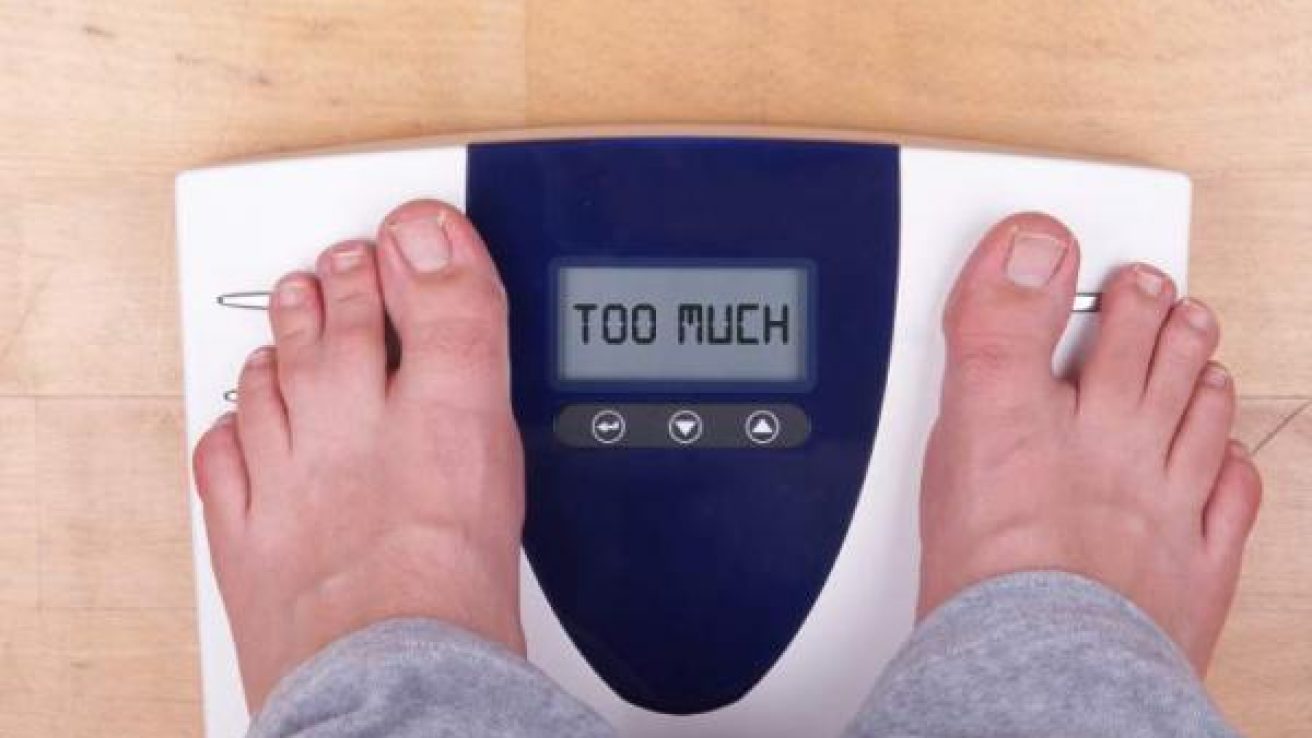 Excess Body Weight Tied to Higher Health Costs Across BMI Levels