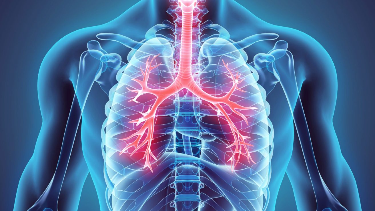 Inhaled Treprostinil Beneficial in Pulmonary Hypertension