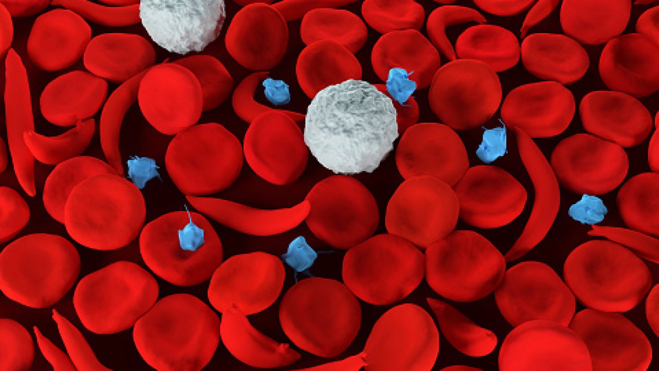 3d render of sickle cell anemia blood cells