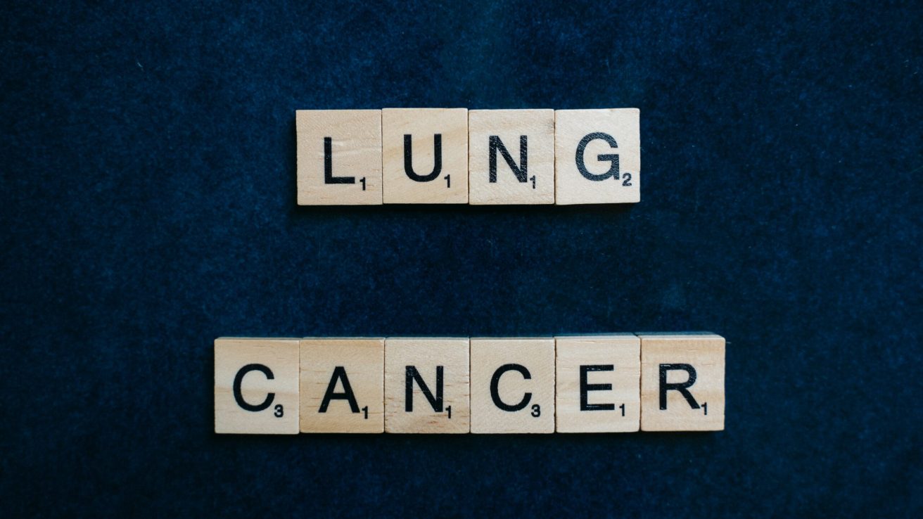 Pralsetinib can be used as a first-line therapy in treatment-naive patients diagnosed with RET fusion-positive non-small-cell lung cancer.