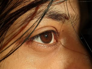 Immune activity in the eye during vision loss was similar to that found in the skin during pigmentation loss in an animal model of vitiligo.