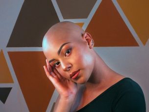 Alopecia areata causes patchy hair loss and can affect patients emotionally, leading to higher rates of depression and anxiety and a reduced quality of life.