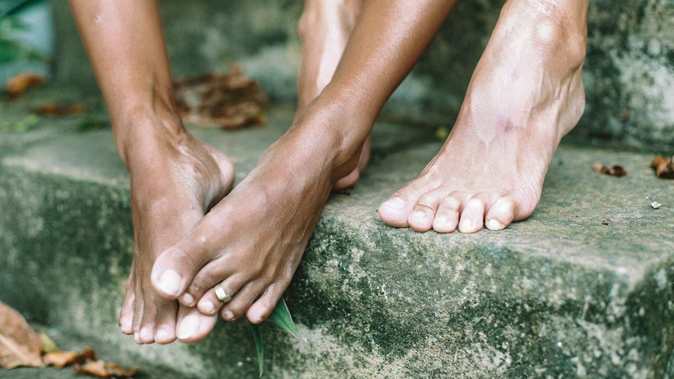 Diabetic foot ulcers can cause a wide range of complications, but more aggressive management solutions and population-based screenings can help decrease their burden.