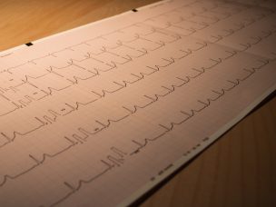 There is a high prevalence of arrhythmias in cardiac amyloidosis patients, with implantable devices and catheter ablation showing partial effectiveness in their treatment.