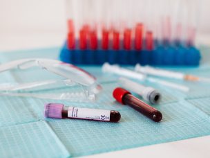 The prognostic value of circulating plasma cells in patients with newly diagnosed multiple myeloma was examined in a recent study. Using advanced testing, the study provides insights that could reshape how we predict and treat multiple myeloma.